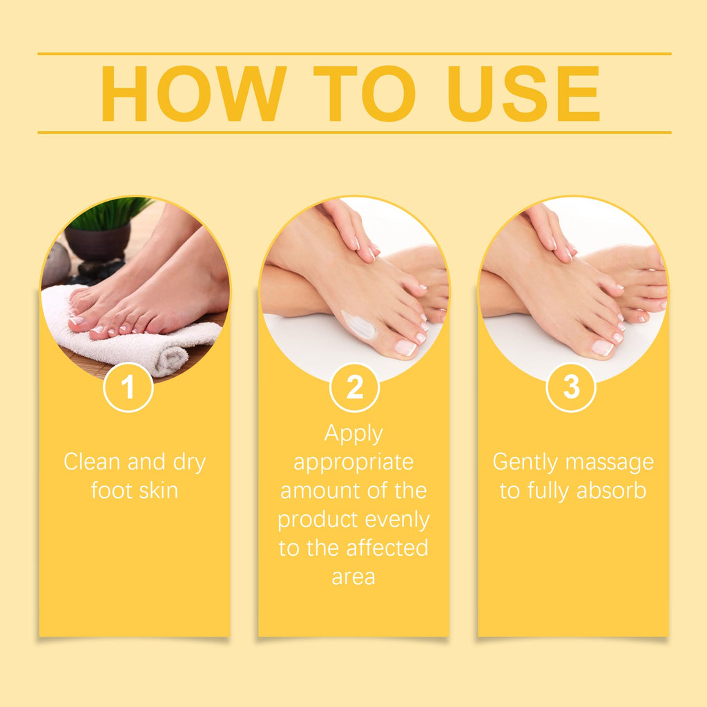 Bee Venom Care Cream, Bee Venom Care Cream To Relieve Inflammation, Pain Swelling Can Improve Joint Health Bunions Adjuvant Therapy