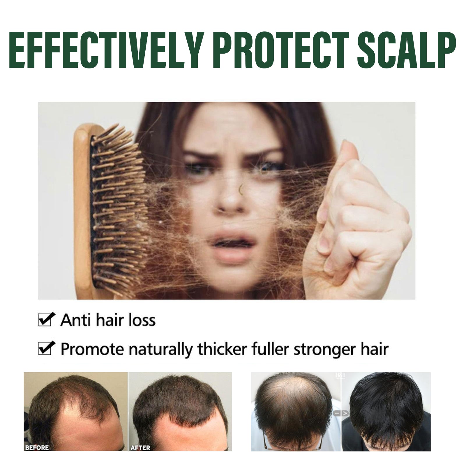 Amla Anti Hair Thinning Shampoo, Scalp Cleanness Moist Smooth Shiny Hair, Dense Hair Wash Protect Suits
