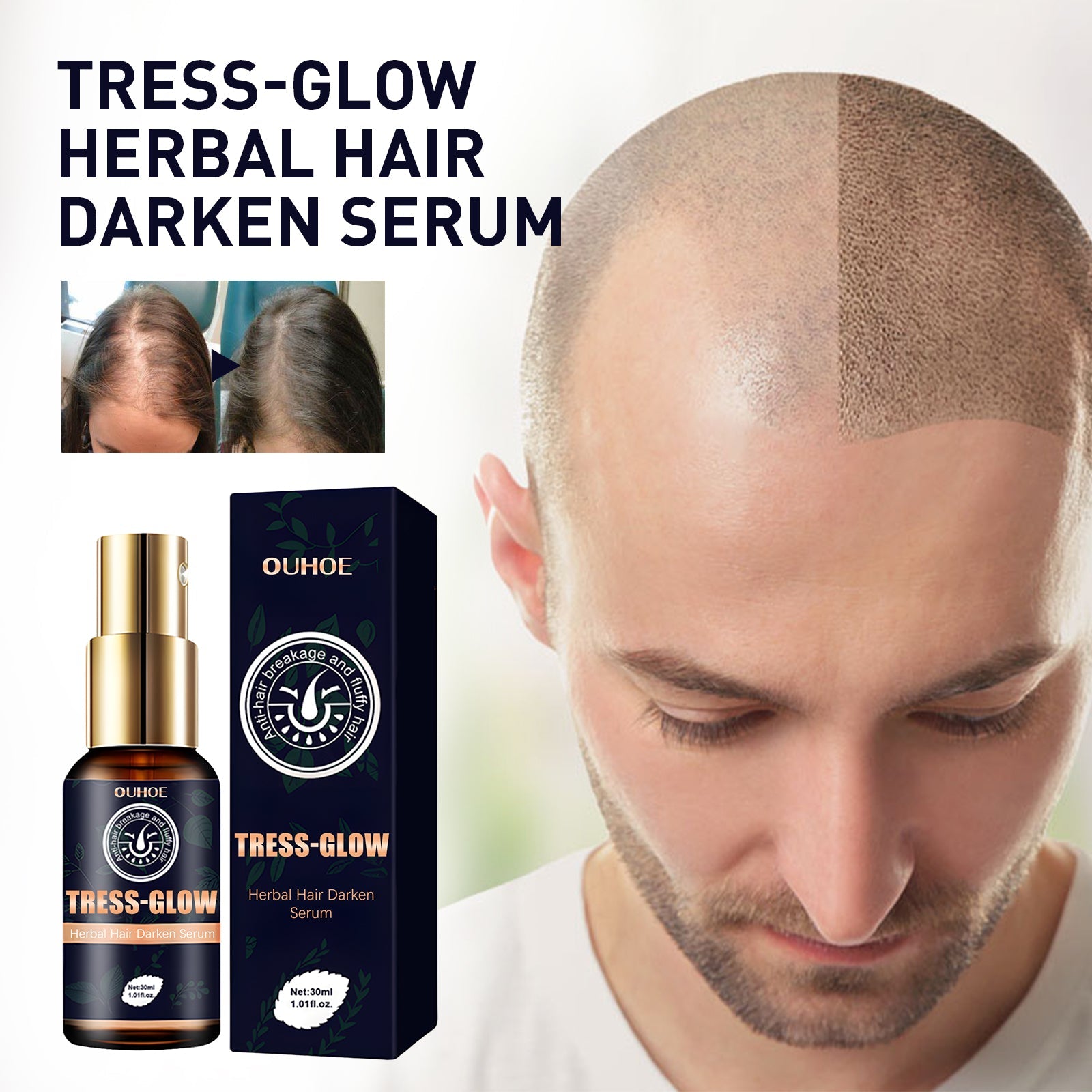 Herbal Hair Essence, Moisturizes Scalp Strong Hair Roots Thick Beard Care Essence