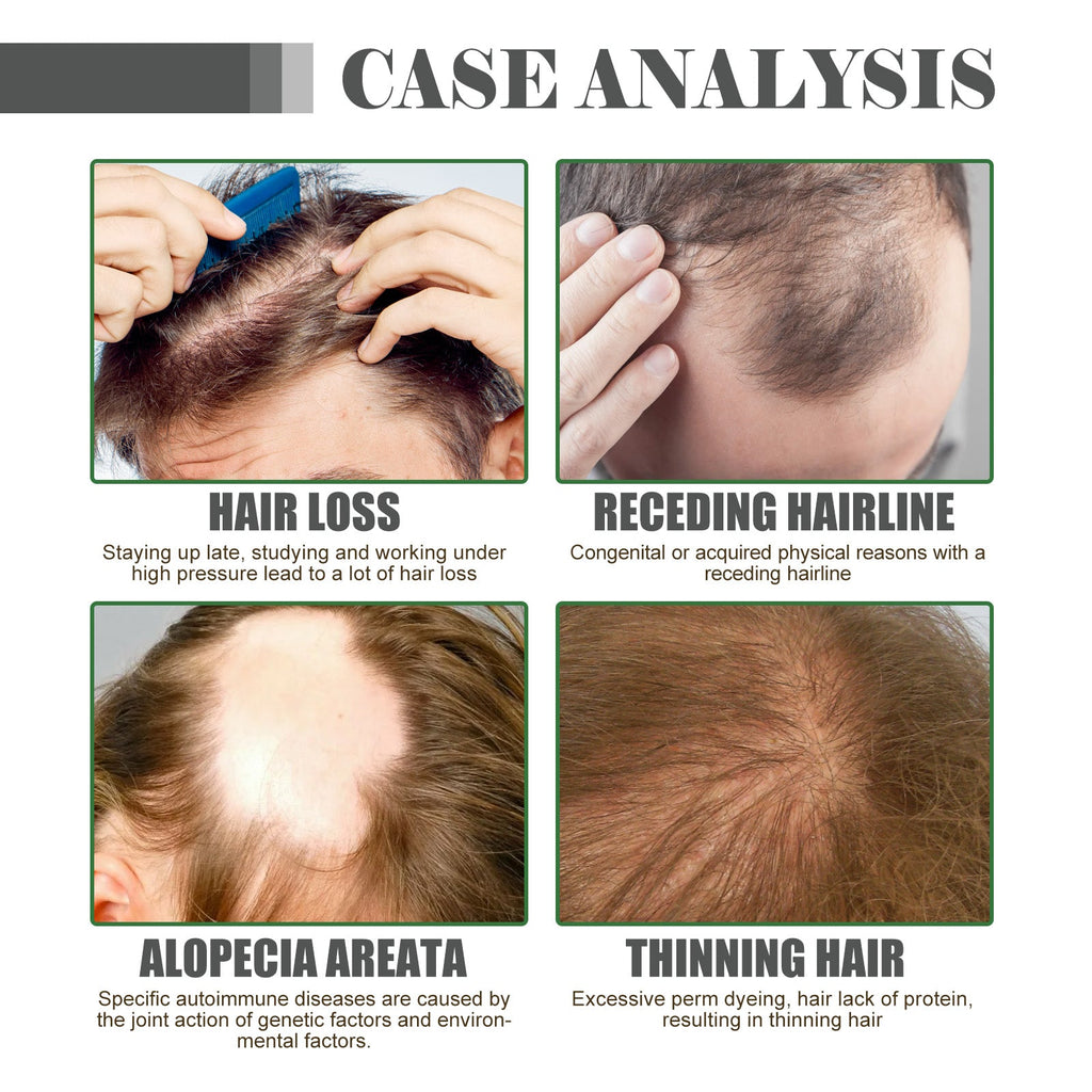 Hair Density Growth Essential Oil, Nourishing Hair Root Repair Perming Dry Damaged Hair Supple Hair Care Essential Oil
